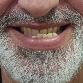 Caso clínico autorizado, antes do tratamento odontológico