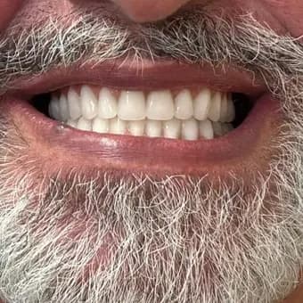 Caso clínico autorizado, depois do tratamento odontológico